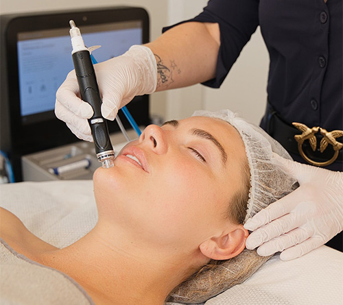 Hydrafacial